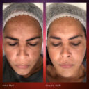 Dual-serum-resultadoa-AJUSTADA